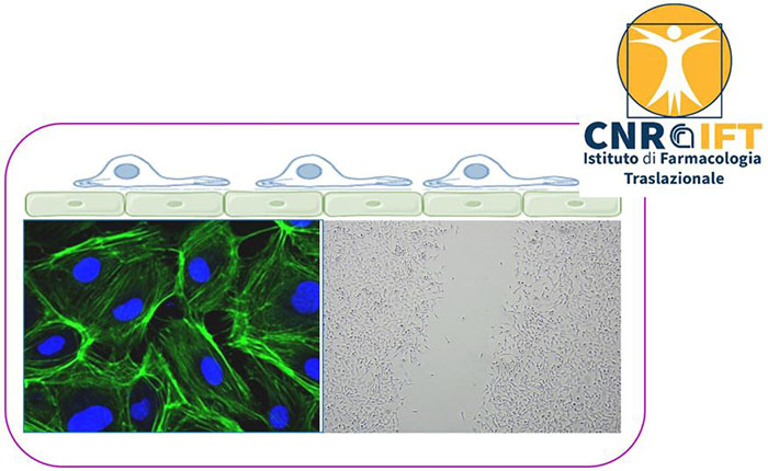 IFT - Istituto di Farmacologia Traslazionale